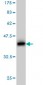 PRKCD Antibody (monoclonal) (M06)