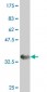 PRPF19 Antibody (monoclonal) (M07)