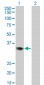 PRPS2 Antibody (monoclonal) (M02)