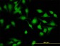 PSCD2 Antibody (monoclonal) (M02)