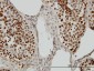 PSIP1 Antibody (monoclonal) (M01)