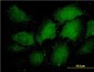 PSMA1 Antibody (monoclonal) (M01)