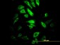 PSMB10 Antibody (monoclonal) (M01)