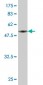 PSMB10 Antibody (monoclonal) (M01)