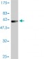 PSMB4 Antibody (monoclonal) (M01)