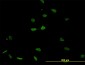 PSMB8 Antibody (monoclonal) (M01)