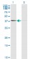 PSMB8 Antibody (monoclonal) (M01)