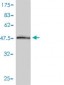 PSME2 Antibody (monoclonal) (M01)