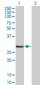 PSME2 Antibody (monoclonal) (M01)