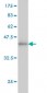 PSME2 Antibody (monoclonal) (M02)