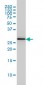 PSME2 Antibody (monoclonal) (M02)