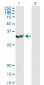 PSME2 Antibody (monoclonal) (M02)