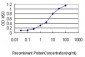 PSPH Antibody (monoclonal) (M02)