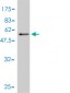 PSPH Antibody (monoclonal) (M02)