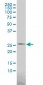 PSPH Antibody (monoclonal) (M02)