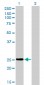 PSPH Antibody (monoclonal) (M02)