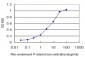 PSPH Antibody (monoclonal) (M06)