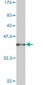 PSPH Antibody (monoclonal) (M06)