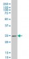 PSPH Antibody (monoclonal) (M06)