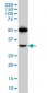 PTGIR Antibody (monoclonal) (M01)