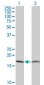 PTH Antibody (monoclonal) (M14)