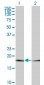 PTH Antibody (monoclonal) (M19)