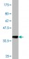 PTK7 Antibody (monoclonal) (M02)