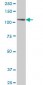 PTK7 Antibody (monoclonal) (M02)