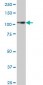 PTK7 Antibody (monoclonal) (M06)