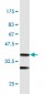 PTMA Antibody (monoclonal) (M02)