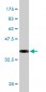 PTN Antibody (monoclonal) (M01)