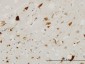 PTN Antibody (monoclonal) (M02)