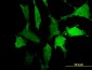 PTPNS1 Antibody (monoclonal) (M10)