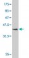 PTX3 Antibody (monoclonal) (M01)
