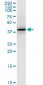 PTX3 Antibody (monoclonal) (M01)