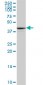 PTX3 Antibody (monoclonal) (M01)