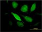 PTX3 Antibody (monoclonal) (M02)