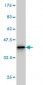 PTX3 Antibody (monoclonal) (M02)