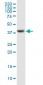 PTX3 Antibody (monoclonal) (M02)