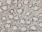 QARS Antibody (monoclonal) (M01)