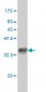 QARS Antibody (monoclonal) (M01)