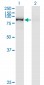QARS Antibody (monoclonal) (M01)