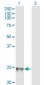 RAB1B Antibody (monoclonal) (M02)