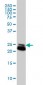 RAB21 Antibody (monoclonal) (M01)