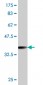 RAB27A Antibody (monoclonal) (M01)