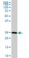 RAB27A Antibody (monoclonal) (M01)