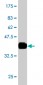 RAB27A Antibody (monoclonal) (M02)