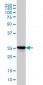 RAB27A Antibody (monoclonal) (M02)