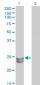 RAB27A Antibody (monoclonal) (M02)