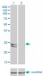 RAB27A Antibody (monoclonal) (M02)